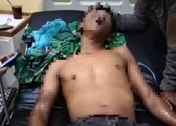 Tabung Gas Meledak, Pegawai Dapur MBG di Cidaun Alami Luka Bakar