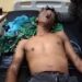 Tabung Gas Meledak, Pegawai Dapur MBG di Cidaun Alami Luka Bakar