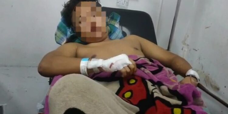 Pulang dari Warung, Seorang Pemuda di Sukaluyu Dibacok Kelompok Bermotor