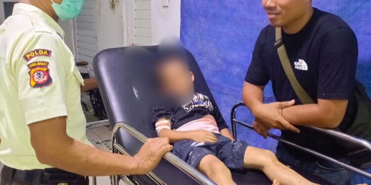 Asyik Bermain di Belakang Rumah, Seorang Anak di Cibeber Diserang Monyet Liar