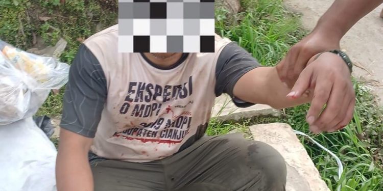 Balai Besar TNGGP Dorong Polisi Tangani Kasus Dugaan Penganiayaan Petugas